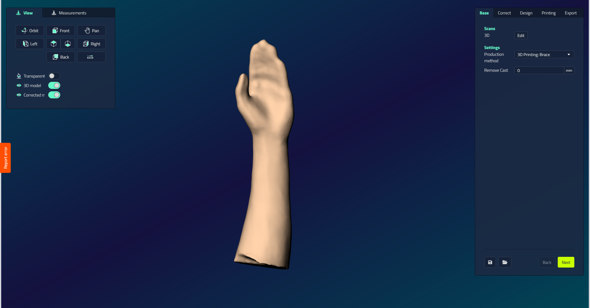 Il passo di base di una mano splint, che mostra la sezione Scansioni con un pulsante Modifica 3D e Impostazioni con il metodo di produzione a discesa impostato su Stampa 3D: Brace e un campo Rimuovi cast